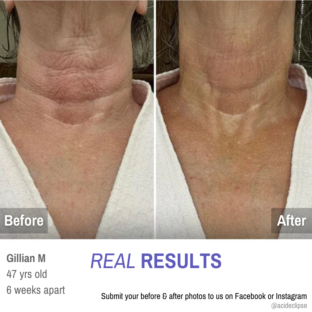 GoPure™ Tighten & Lift Neck Cream